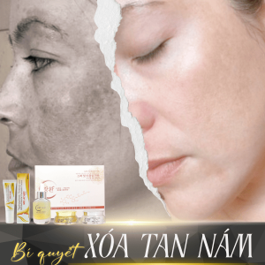 Janghwan Melasma Cream